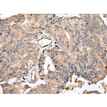 Immunohistochemistry - TESC Antibody from Signalway Antibody (42973) - Antibodies.com