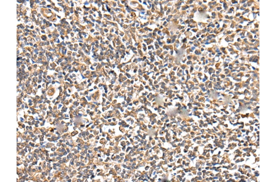 Immunohistochemistry - TESC Antibody from Signalway Antibody (42973) - Antibodies.com