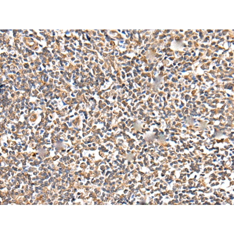 Immunohistochemistry - TESC Antibody from Signalway Antibody (42973) - Antibodies.com