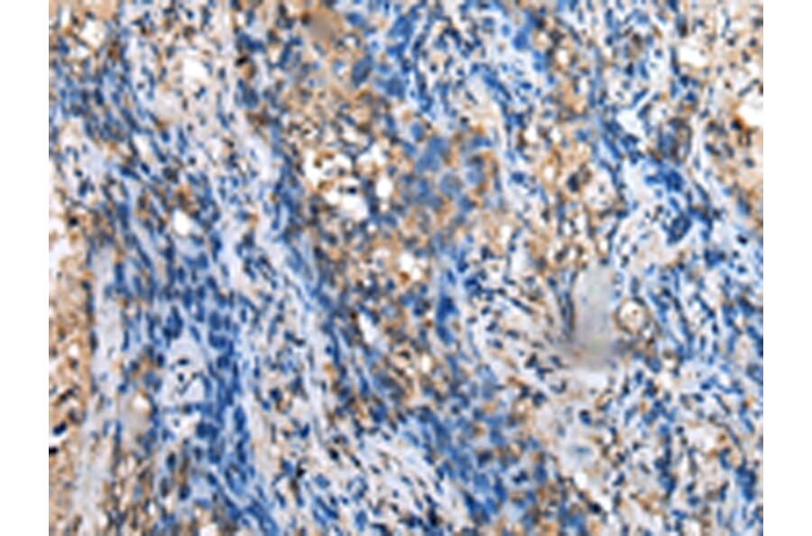 Immunohistochemistry - MOB4 Antibody from Signalway Antibody (42988) - Antibodies.com