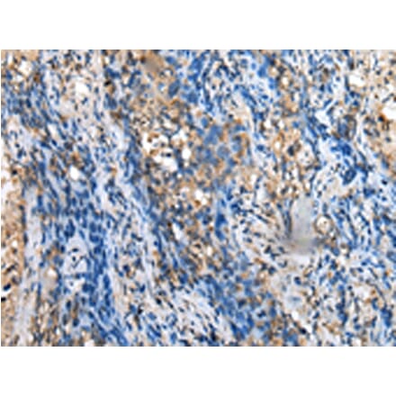 Immunohistochemistry - MOB4 Antibody from Signalway Antibody (42988) - Antibodies.com