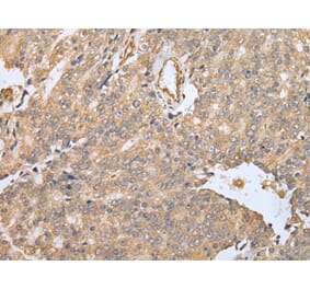 Immunohistochemistry - EBI3 Antibody from Signalway Antibody (42991) - Antibodies.com