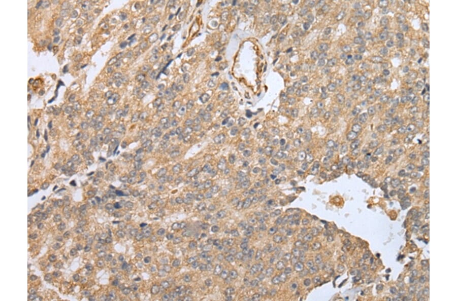 Immunohistochemistry - EBI3 Antibody from Signalway Antibody (42991) - Antibodies.com