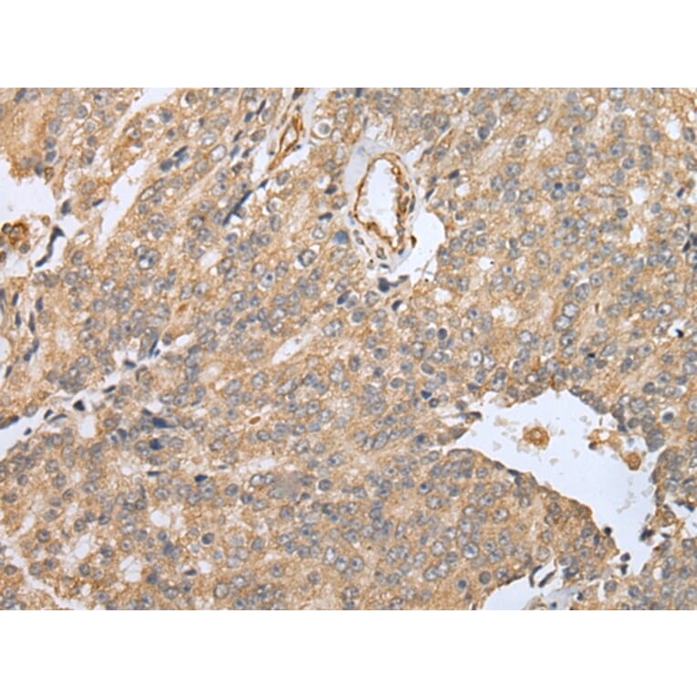 Immunohistochemistry - EBI3 Antibody from Signalway Antibody (42991) - Antibodies.com