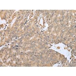 Immunohistochemistry - EBI3 Antibody from Signalway Antibody (42991) - Antibodies.com