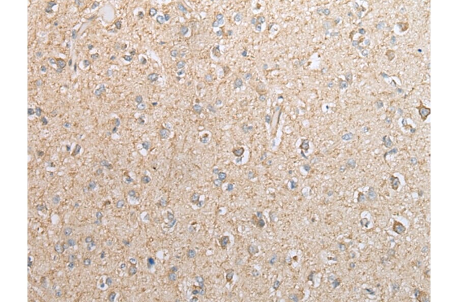 Immunohistochemistry - EBI3 Antibody from Signalway Antibody (42991) - Antibodies.com