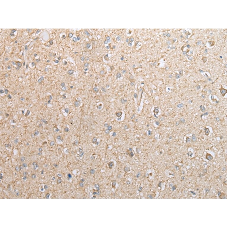 Immunohistochemistry - EBI3 Antibody from Signalway Antibody (42991) - Antibodies.com