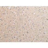 Immunohistochemistry - EBI3 Antibody from Signalway Antibody (42991) - Antibodies.com