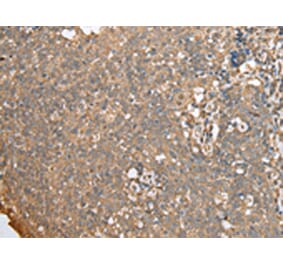 Immunohistochemistry - ECI1 Antibody from Signalway Antibody (42997) - Antibodies.com