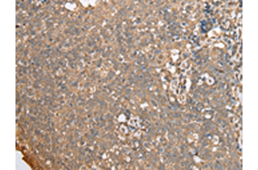 Immunohistochemistry - ECI1 Antibody from Signalway Antibody (42997) - Antibodies.com