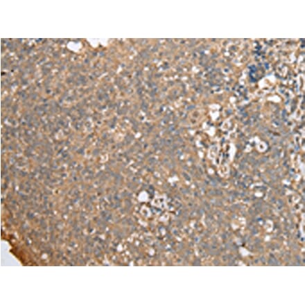 Immunohistochemistry - ECI1 Antibody from Signalway Antibody (42997) - Antibodies.com