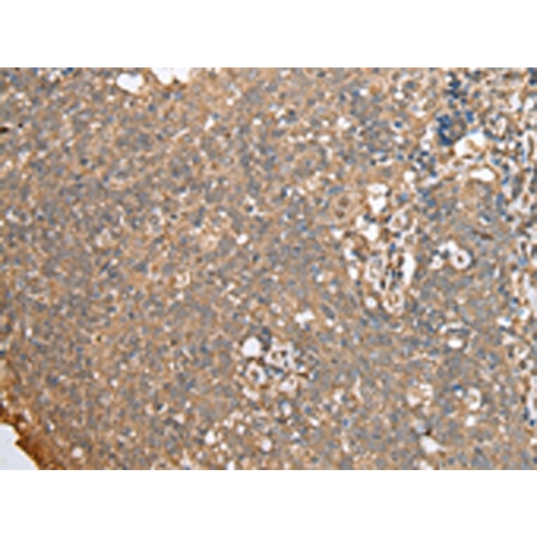 Immunohistochemistry - ECI1 Antibody from Signalway Antibody (42997) - Antibodies.com