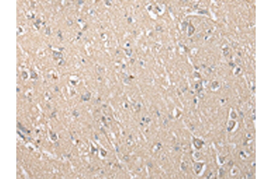 Immunohistochemistry - ECI1 Antibody from Signalway Antibody (42997) - Antibodies.com