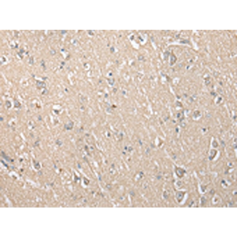 Immunohistochemistry - ECI1 Antibody from Signalway Antibody (42997) - Antibodies.com