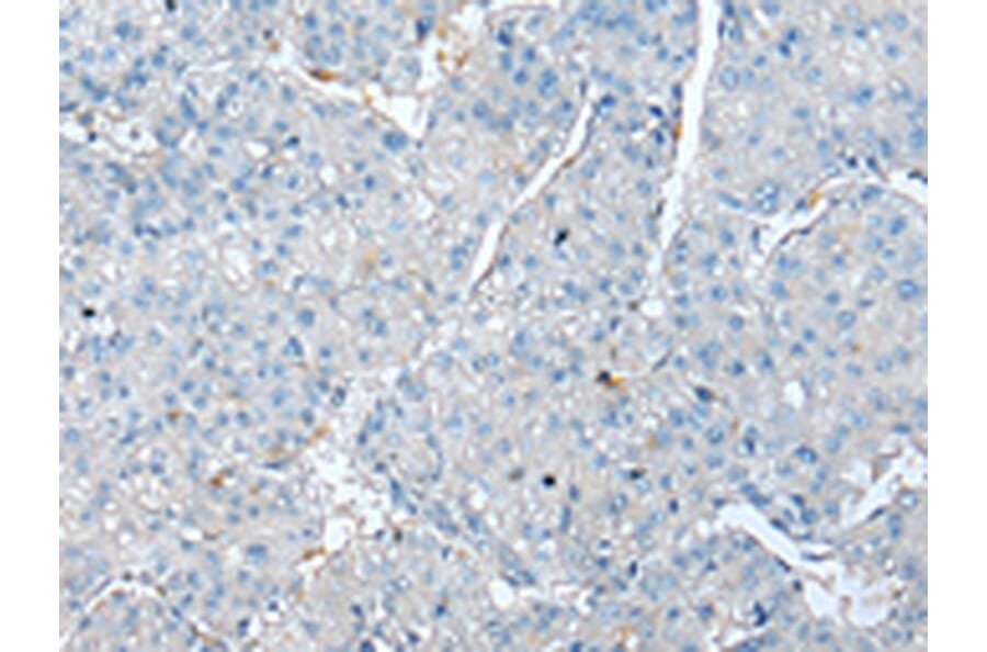 Immunohistochemistry - TPM4 Antibody from Signalway Antibody (43002) - Antibodies.com