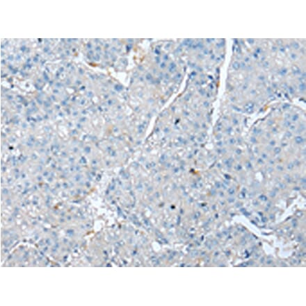 Immunohistochemistry - TPM4 Antibody from Signalway Antibody (43002) - Antibodies.com