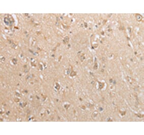 Immunohistochemistry - GCLC Antibody from Signalway Antibody (43004) - Antibodies.com