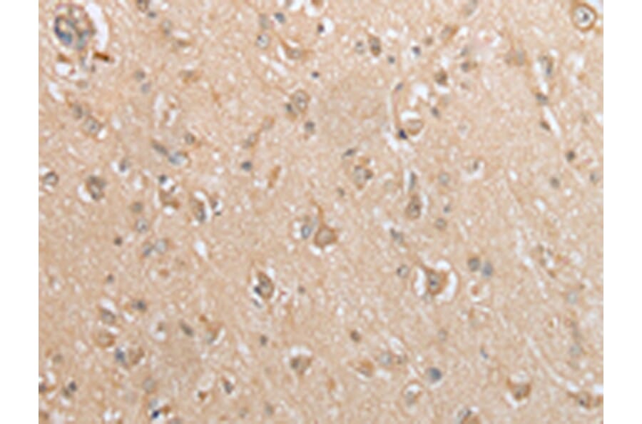 Immunohistochemistry - GCLC Antibody from Signalway Antibody (43004) - Antibodies.com