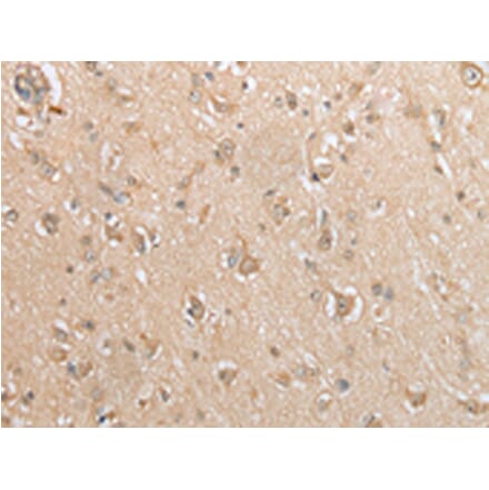 Immunohistochemistry - GCLC Antibody from Signalway Antibody (43004) - Antibodies.com