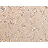 Immunohistochemistry - GCLC Antibody from Signalway Antibody (43004) - Antibodies.com