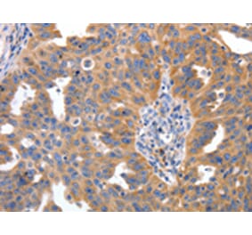 Immunohistochemistry - IRS2 Antibody from Signalway Antibody (43094) - Antibodies.com