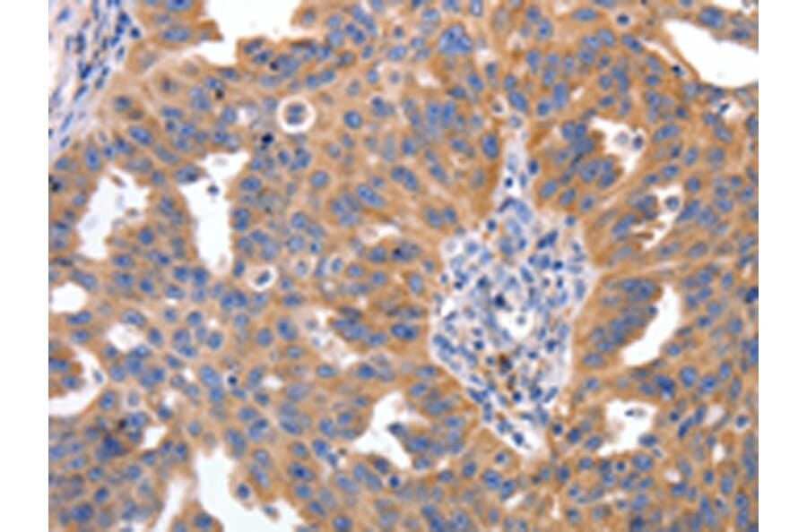 Immunohistochemistry - IRS2 Antibody from Signalway Antibody (43094) - Antibodies.com