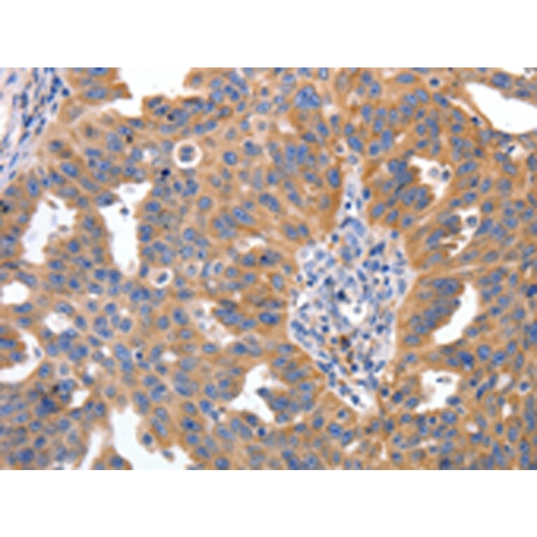 Immunohistochemistry - IRS2 Antibody from Signalway Antibody (43094) - Antibodies.com