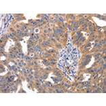 Immunohistochemistry - IRS2 Antibody from Signalway Antibody (43094) - Antibodies.com