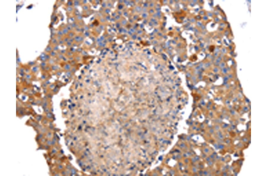 Immunohistochemistry - IRS2 Antibody from Signalway Antibody (43094) - Antibodies.com