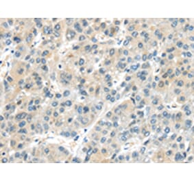 Immunohistochemistry - AHI1 Antibody from Signalway Antibody (43102) - Antibodies.com