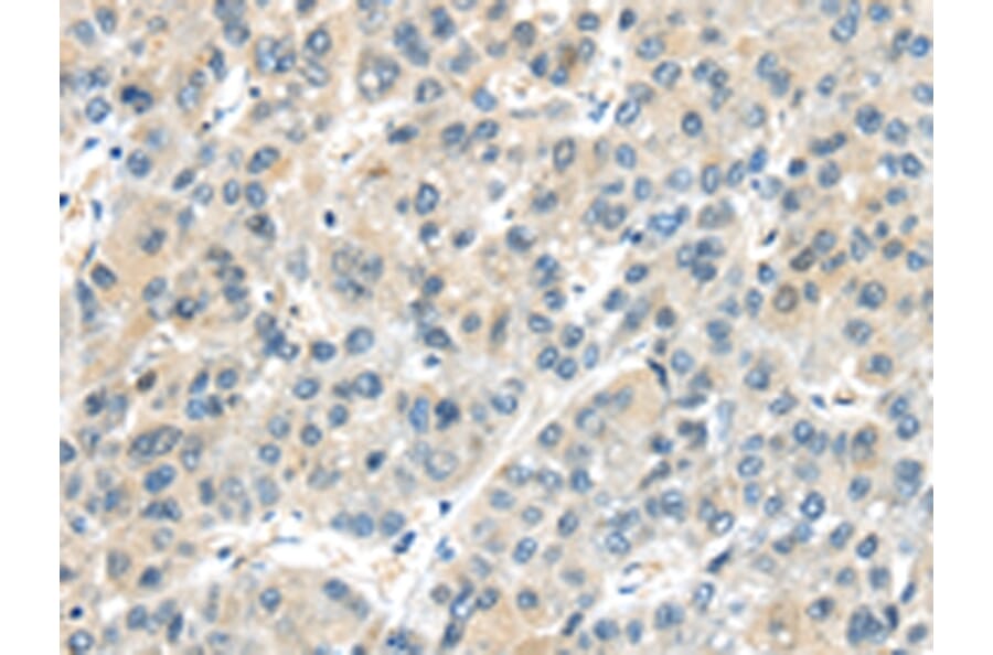 Immunohistochemistry - AHI1 Antibody from Signalway Antibody (43102) - Antibodies.com