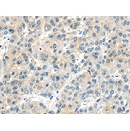 Immunohistochemistry - AHI1 Antibody from Signalway Antibody (43102) - Antibodies.com