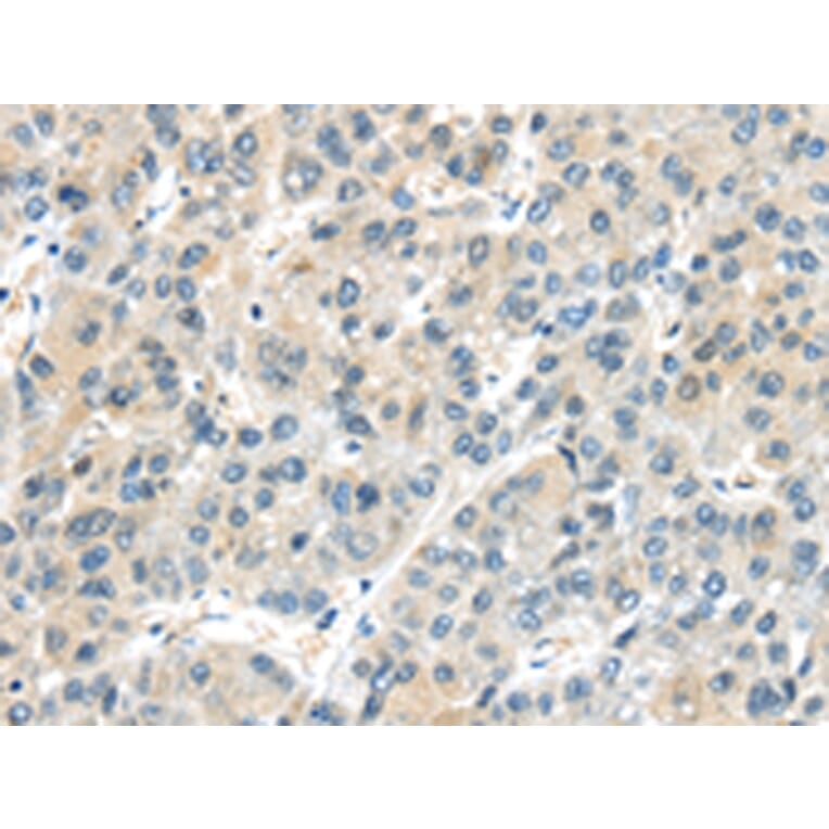 Immunohistochemistry - AHI1 Antibody from Signalway Antibody (43102) - Antibodies.com