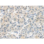 Immunohistochemistry - AHI1 Antibody from Signalway Antibody (43102) - Antibodies.com