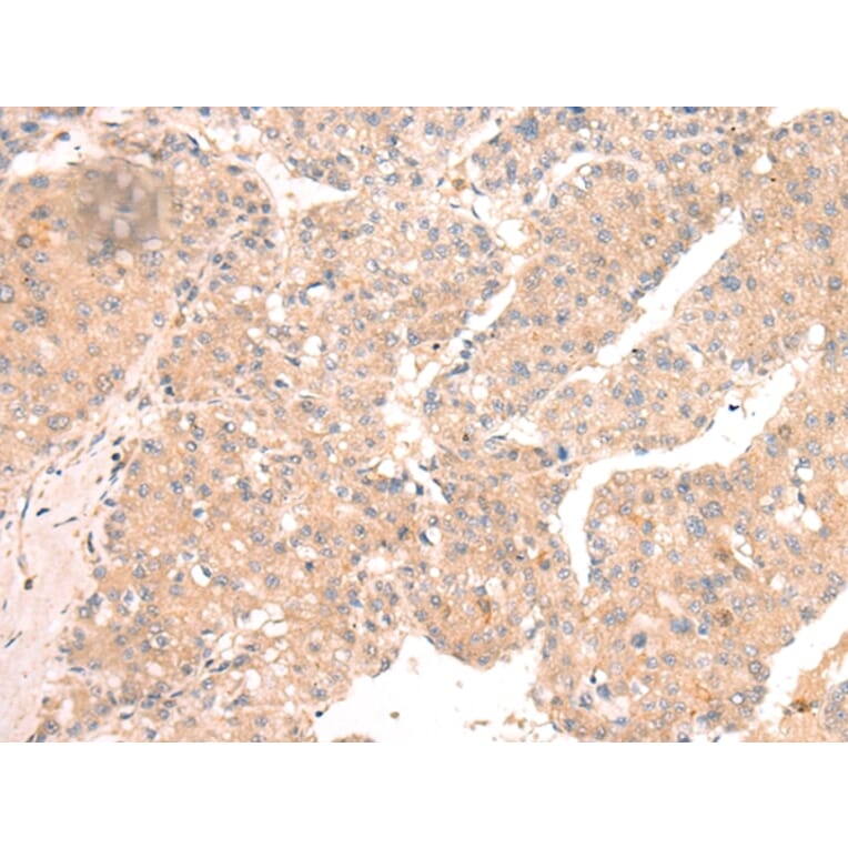 Immunohistochemistry - TLR9 Antibody from Signalway Antibody (43103) - Antibodies.com