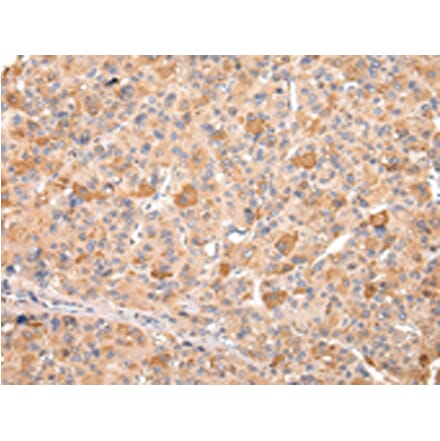 Immunohistochemistry - RERE Antibody from Signalway Antibody (43107) - Antibodies.com