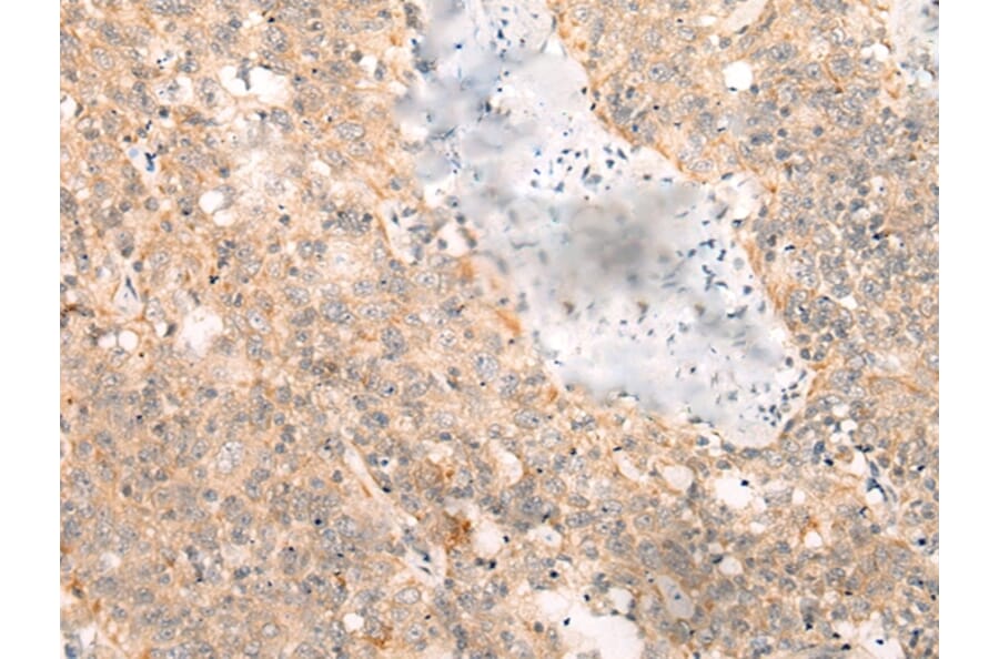 Immunohistochemistry - LRP8 Antibody from Signalway Antibody (43118) - Antibodies.com