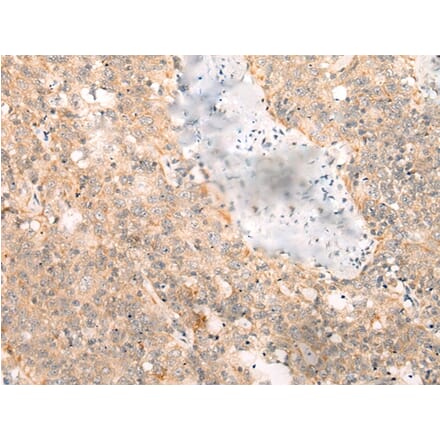 Immunohistochemistry - LRP8 Antibody from Signalway Antibody (43118) - Antibodies.com