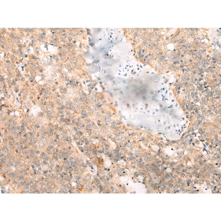 Immunohistochemistry - LRP8 Antibody from Signalway Antibody (43118) - Antibodies.com