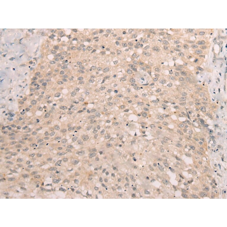Immunohistochemistry - LRP8 Antibody from Signalway Antibody (43118) - Antibodies.com