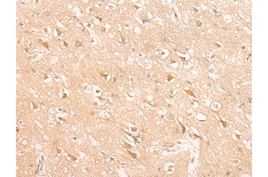 Immunohistochemistry - HIRA Antibody from Signalway Antibody (43121) - Antibodies.com