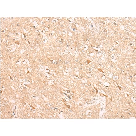 Immunohistochemistry - HIRA Antibody from Signalway Antibody (43121) - Antibodies.com