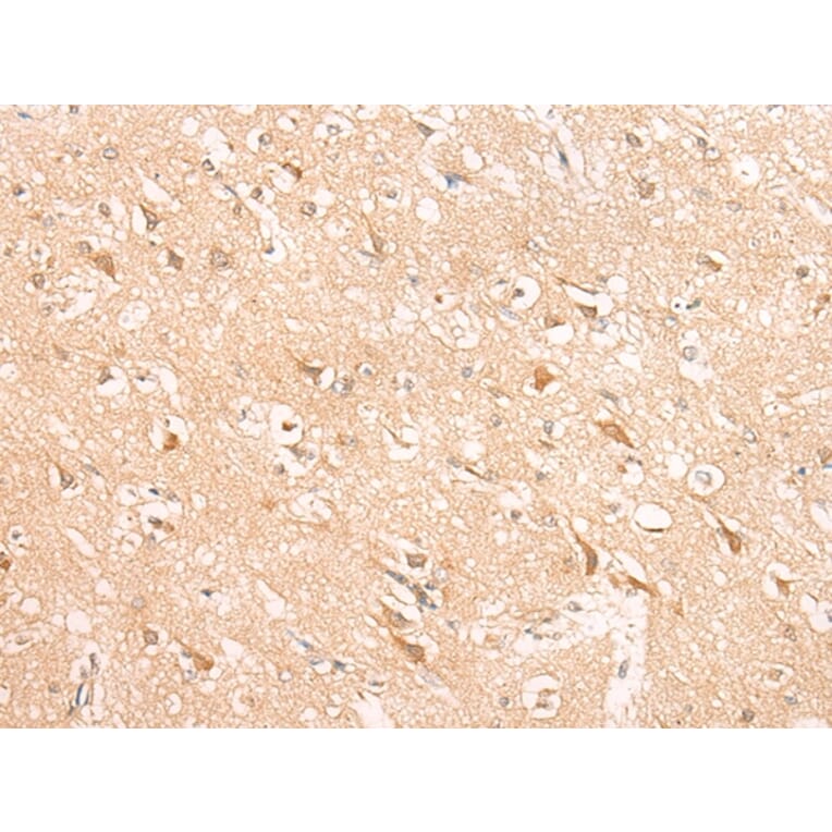 Immunohistochemistry - HIRA Antibody from Signalway Antibody (43121) - Antibodies.com