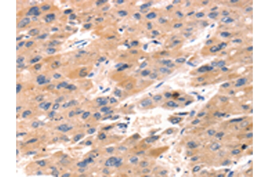 Immunohistochemistry - TAP2 Antibody from Signalway Antibody (43156) - Antibodies.com