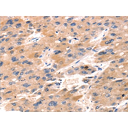 Immunohistochemistry - TAP2 Antibody from Signalway Antibody (43156) - Antibodies.com