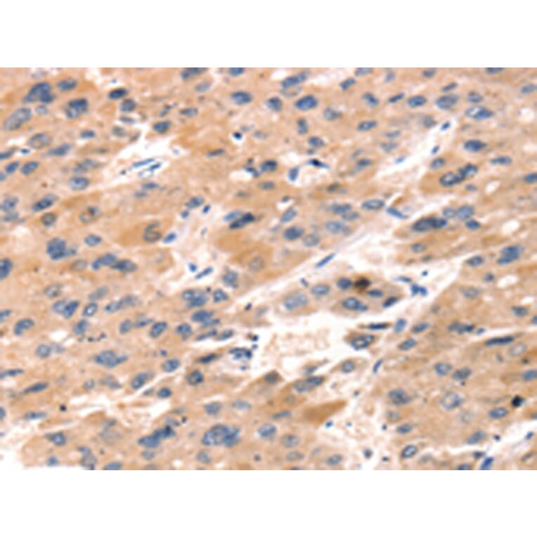 Immunohistochemistry - TAP2 Antibody from Signalway Antibody (43156) - Antibodies.com
