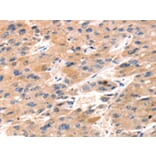 Immunohistochemistry - TAP2 Antibody from Signalway Antibody (43156) - Antibodies.com