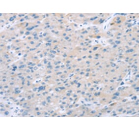 Immunohistochemistry - EI24 Antibody from Signalway Antibody (43165) - Antibodies.com