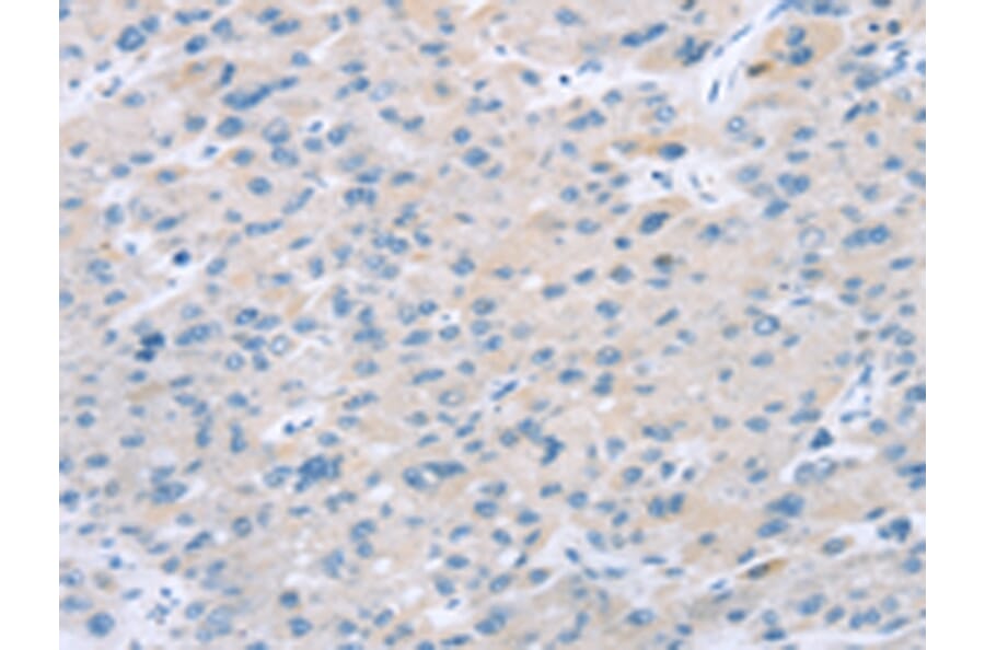 Immunohistochemistry - EI24 Antibody from Signalway Antibody (43165) - Antibodies.com