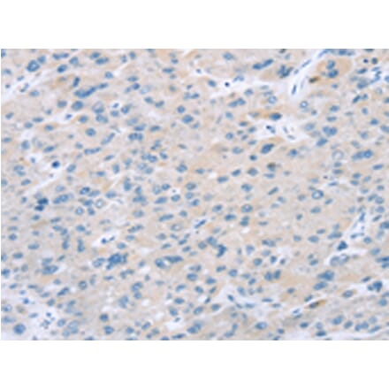 Immunohistochemistry - EI24 Antibody from Signalway Antibody (43165) - Antibodies.com